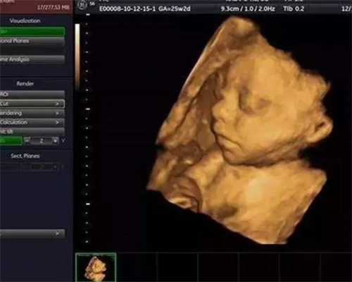 代孕正规医院,排卵期同房后助孕食物有什么