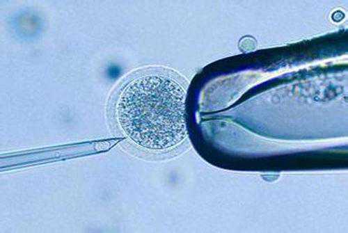 孕妇早期饮食规划：芦笋的安全性与健康选择