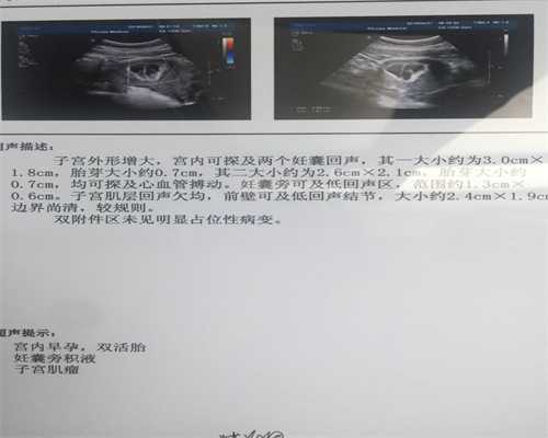 试管接受供卵_试管捐卵贴吧,做了试管婴儿后,试管流产率高不高