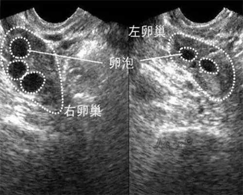 有供卵试管医院_供卵中心靠谱吗,2026年珠海市供卵试管助孕医院排名汇总，内附