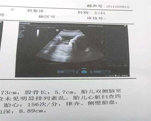 代孕怎么受精啊_怎样能找到代孕都女孩_45岁高龄为生儿子去泰国试管哪家医院