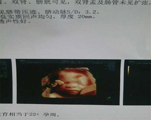 全球哪里代孕是合法的_想咨询代孕_上海正规孕公司：上海供卵试管费用是多少