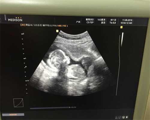 有代孕吗2021_代孕成功率最高的_广州三代供卵包生儿子真的吗？是如何操作的？