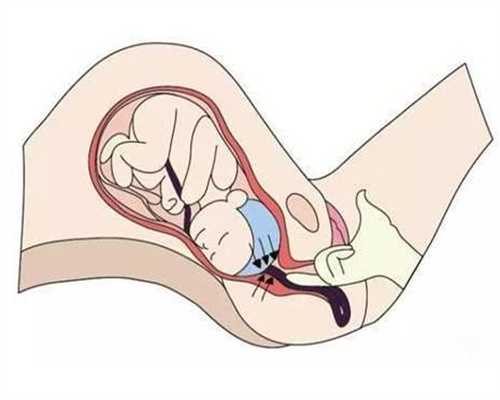 代孕生殖中心选性别_做代孕步骤是怎样_试管婴儿移植手术之后有点嗜睡，该怎