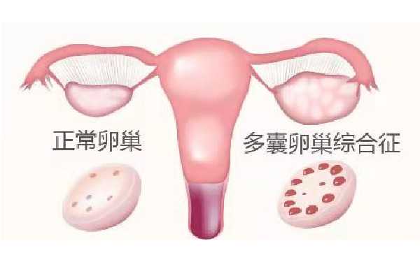 qq上代孕的可靠吗_代孕生殖医疗_美国试管婴儿移植两个囊胚，怀双胎的成功率
