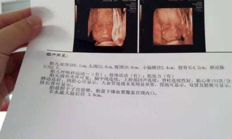 南京地下供卵靠谱吗 南京医科大学附属妇产医院： ‘三围彩超看男女’